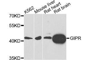 Western blot analysis of extracts of various cell lines, using GIPR antibody. (GIPR antibody)