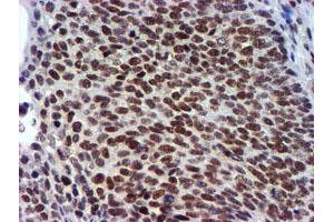 Image no. 5 for anti-Ubiquitin Specific Peptidase 7 (Herpes Virus-Associated) (USP7) antibody (ABIN1498592) (USP7 antibody)