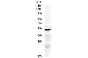 Western blot testing of human COLO320 cell lysate with NDRG3 antibody at 0.