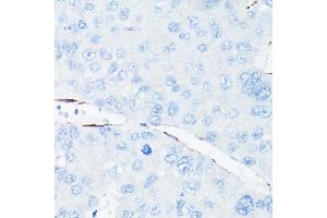 Immunohistochemistry (IHC) image for anti-Cadherin 5 (CDH5) (AA 650-750) antibody (ABIN6138297)