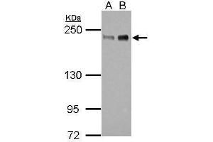 WB Image Sample (30 ug of whole cell lysate) A: 293T B: HeLa 5% SDS PAGE antibody diluted at 1:1000 (ZEB1 antibody)