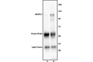 NFATC2 antibody (pAb) tested by Immunoprecipitation. (NFAT1 antibody  (N-Term))