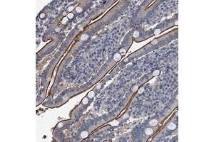 Immunohistochemical staining of human duodenum with IFITM5 polyclonal antibody  shows distinct membranous positivity in glandular cells at 1:50-1:200 dilution. (IFITM5 antibody)
