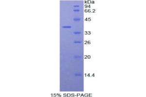 SDS-PAGE analysis of Human Fibulin 4 Protein. (FBLN4 Protein)