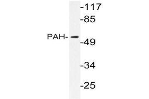 Western blot (WB) analyzes of PAH antibody in extracts from HepG2 cells.