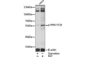 Western blot analysis of extracts of HeLa cells, using Phospho-Paxillin-Y118 antibody (ABIN3019661, ABIN3019662, ABIN3019663 and ABIN1681980) at 1:2000 dilution. (Paxillin antibody  (pTyr118))