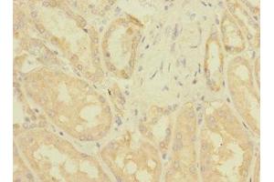 Immunohistochemistry of paraffin-embedded human kidney tissue using ABIN7176445 at dilution of 1:100 (ZNF624 antibody  (AA 127-327))