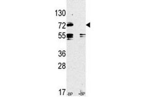 Western blot analysis of anti-TLR2 antibody pre-incubated without and with blocking peptide in CEM lysate (TLR2 antibody  (AA 720-749))