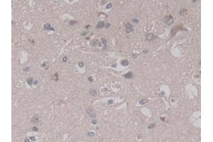 Detection of RALA in Human Cerebrum Tissue using Monoclonal Antibody to V-Ral Simian Leukemia Viral Oncogene Homolog A (RALA) (rala antibody  (AA 1-206))