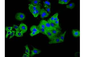 Immunofluorescence staining of HepG2 cells with ABIN7163713 at 1:33, counter-stained with DAPI. (Plexin C1 antibody  (AA 81-218))