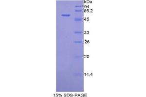SDS-PAGE analysis of Mouse Fusion Protein. (Fusion (FUS) Protein)