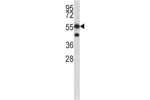 Western Blotting (WB) image for anti-3-Hydroxy-3-Methylglutaryl-CoA Synthase 1 (Soluble) (HMGCS1) antibody (ABIN3002731) (HMGCS1 antibody)