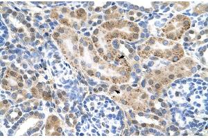 Human kidney (SLC22A3 antibody  (N-Term))