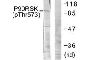 Western blot analysis of extracts from 293 cells treated with UV 30', using p90 RSK (Phospho-Thr573) Antibody. (RPS6KA3 antibody  (pThr573))