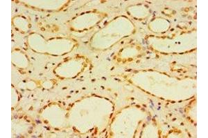 Immunohistochemistry of paraffin-embedded human kidney tissue using ABIN7150785 at dilution of 1:100 (DUSP7 antibody  (AA 160-419))