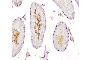 IHC analysis of DMRT1 using anti-DMRT1 antibody (ABIN3043450).