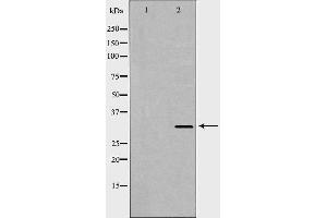 Western blot analysis of Hepg2 whole cell lysates, using HAVCR2 Antibody. (TIM3 antibody  (C-Term))