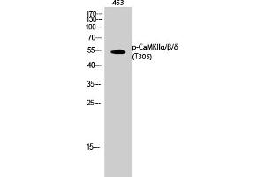 Western Blotting (WB) image for anti-CaMKIIalpha/beta/delta (pThr305) antibody (ABIN5956091) (CaMKIIalpha/beta/delta (pThr305) antibody)