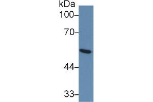 Detection of GLUT1 in Human Serum using Monoclonal Antibody to Glucose Transporter 1 (GLUT1) (GLUT1 antibody  (AA 251-329))