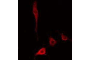 ABIN6274779 staining HepG2 cells by IF/ICC. (RPL34 antibody)