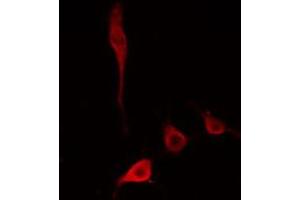 ABIN6274779 staining HepG2 cells by IF/ICC.