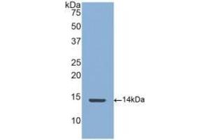 Detection of Recombinant CTGF, Human using Polyclonal Antibody to Connective Tissue Growth Factor (CTGF) (CTGF antibody  (AA 248-349))