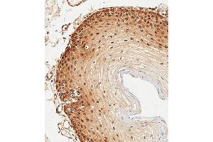Immunohistochemical analysis of paraffin-embedded Human esophagus tissue using (ABIN6243695 and ABIN6578909) performed on the Leica® BOND RXm. (HSP70 1A antibody)