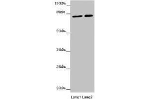 Western blot All lanes: DHX33 antibody at 16 μg/mL Lane 1: Hela whole cell lysate Lane 2: 293T whole cell lysate Secondary Goat polyclonal to rabbit IgG at 1/10000 dilution Predicted band size: 79, 61 kDa Observed band size: 79 kDa (DHX33 antibody  (AA 116-357))