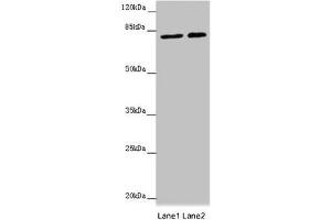 Western blot All lanes: DHX33 antibody at 16 μg/mL Lane 1: Hela whole cell lysate Lane 2: 293T whole cell lysate Secondary Goat polyclonal to rabbit IgG at 1/10000 dilution Predicted band size: 79, 61 kDa Observed band size: 79 kDa