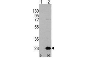 Western blot analysis of HSPB1 (arrow) using rabbit polyclonal HSPB1 Antibody 293 cell lysates (2 µg/lane) either nontransfected (Lane 1) or transiently transfected with the HSPB1 gene (Lane 2)