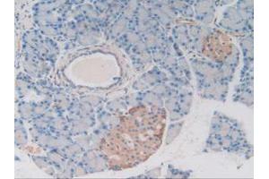 IHC-P analysis of Rat Pancreas Tissue, with DAB staining. (MAP4 antibody  (AA 2-250))