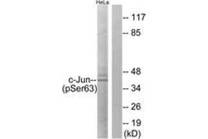 Western blot analysis of extracts from HeLa cells treated with UV, using c-Jun (Phospho-Ser63) Antibody. (C-JUN antibody  (AA 31-80))