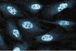 Immunofluorescence staining of human endothelial cells. (RAD50 antibody  (AA 672-786))