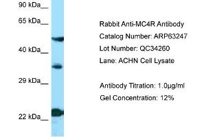 Western Blotting (WB) image for anti-Melanocortin 4 Receptor (MC4R) (N-Term) antibody (ABIN2789422) (MC4R antibody  (N-Term))