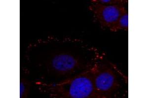 Immunofluorescence staining of methanol-fixed HeLa cells using PTK2 (phospho Y576/577) polyclonal antibody (Cat # PAB25916, red). (FAK antibody  (pTyr576, pTyr577))