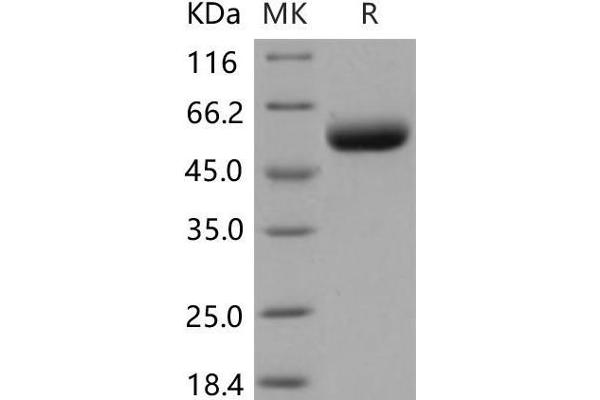 ST6GAL1 Protein (His tag)