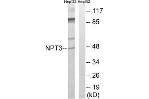 Western blot analysis of extracts from HepG2 cells, using SLC17A2 antibody. (SLC17A2 antibody  (Internal Region))