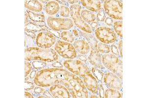 Immunohistochemistry of paraffin-embedded rat kidney using G Rabbit pAb (ABIN6133219, ABIN6140940, ABIN6140941 and ABIN6222644) at dilution of 1:450 (40x lens). (GALNT2 antibody  (AA 442-571))