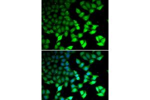 Immunofluorescence analysis of U2OS cells using KDM4B antibody (ABIN5973438). (KDM4B antibody)