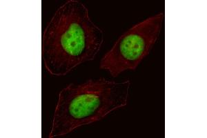 Fluorescent image of Hela cell stained with FOXN3 Antibody (C-term) (ABIN1537230 and ABIN2838260). (FOXN3 antibody  (C-Term))