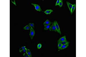 Immunofluorescent analysis of HepG2 cells using ABIN7175380 at dilution of 1:100 and Alexa Fluor 488-congugated AffiniPure Goat Anti-Rabbit IgG(H+L) (FLT1 antibody  (AA 1048-1328))