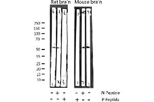 Western blot analysis of Phospho-CaMK2 alpha/ beta/ delta (Thr305) expression in various lysates (CaMK2 alpha/beta/delta antibody  (pThr305))