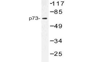Western blot (WB) analysis of p73 antibody in extracts from Jurkat cells. (Tumor Protein p73 antibody)