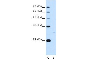 WB Suggested Anti-YWHAZ Antibody Titration:  5. (14-3-3 zeta antibody  (C-Term))