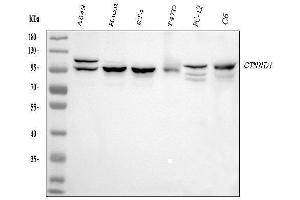 Western blot analysis of CTNND1 using anti-CTNND1 antibody (ABIN7602220). (CTNND1 antibody  (AA 64-930))