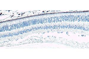 Immunohistochemistry (IHC) image for anti-Arrestin 3, Retinal (X-Arrestin) (ARR3) (C-Term) antibody (ABIN570667)