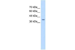 Western Blotting (WB) image for anti-serpin Peptidase Inhibitor, Clade B (Ovalbumin), Member 5 (SERPINB5) (Middle Region) antibody (ABIN2777125)