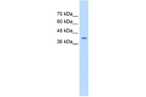 WB Suggested Anti-SERPINB5 Antibody Titration:  0. (SERPINB5 antibody  (Middle Region))