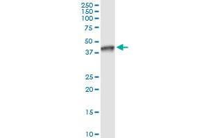 Immunoprecipitation of NSDHL transfected lysate using anti-NSDHL MaxPab rabbit polyclonal antibody and Protein A Magnetic Bead , and immunoblotted with NSDHL purified MaxPab mouse polyclonal antibody (B01P) . (NSDHL antibody  (AA 1-373))