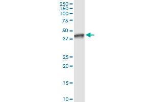 Immunoprecipitation of NSDHL transfected lysate using anti-NSDHL MaxPab rabbit polyclonal antibody and Protein A Magnetic Bead , and immunoblotted with NSDHL purified MaxPab mouse polyclonal antibody (B01P) . (NSDHL antibody  (AA 1-373))